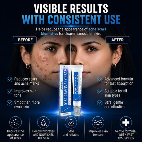 ScarSmooth™ – Great Care Cream for All Types of Skin Marks 🧴